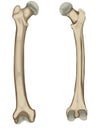 The femur or thigh bone