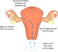 Fertilisation in the Uterus