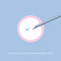 Fertility reproduction of ovum and spermatozoon ICSI