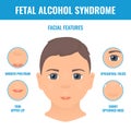 Fetal alcohol syndrome facial features in a child