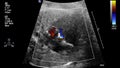 Ultrasound examination of the fetal heart