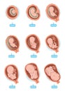 Fetal Growth