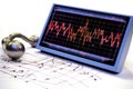 fetal monitor printout with heartbeat and contraction graphs