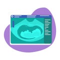 Fetal ultrasound 2D vector isolated illustration