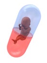 Fetus capsule