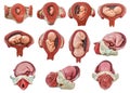 Fetus development in womb model