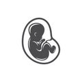 Fetus illustration