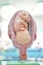 Fetus in seventh month Royalty Free Stock Photo