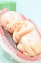 Fetus in seventh month Royalty Free Stock Photo