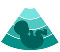 Fetus silhouette design Royalty Free Stock Photo