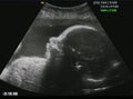 Fetus ultrasound Royalty Free Stock Photo