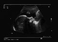 Fetus ultrasound Royalty Free Stock Photo