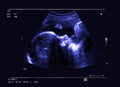 Fetus ultrasound Royalty Free Stock Photo