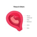 Fetus in utero gynecology infographic diagram. Vector flat healthcare illustration. Embryo in womb with text isolated on white Royalty Free Stock Photo