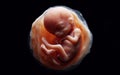 Fetus in the womb of the mother in the uterine sac 3 months gestation before giving birth