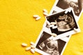 Few photos of the fetus on ultrasound scan and few pills on yellow background