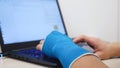 Fiberglass cast hand uses laptop program code Royalty Free Stock Photo