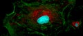 Fibroblast cells: big and small