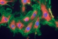 Fibroblast cells mpressionistic