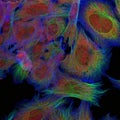 Fibroblasts (skin cells) labeled with fluorescence dyes
