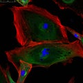 Fibroblasts (skin cells) labeled with fluorescence dyes