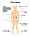 Fibromyalgia. signs and symptoms.