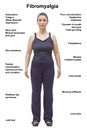 Fibromyalgia symptoms body woman