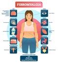 Fibromyalgia vector illustration. Diagnosis symptoms labeled diagram. Royalty Free Stock Photo