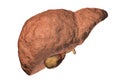 Fibrotic liver illustration