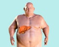 Fibrotic liver in obese man, 3D illustration Royalty Free Stock Photo