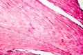 Fibrous cartilage, light micrograph