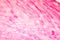 Fibrous cartilage, light micrograph