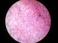 Fibrous tissue