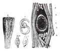 Fig.1210. A. Trichinella isolated. B. Portion of muscle attack w