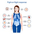 Fight-or-flight-or-freeze. acute stress response