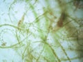 Filamentous algae