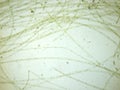 Filamentous algae