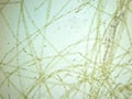 Filamentous algae