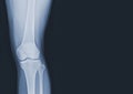 x-ray of human knee normal joints and ligaments Medical image concept Royalty Free Stock Photo