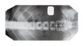 Film with X-ray image of front view of human spine Royalty Free Stock Photo