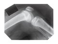 Film with X-ray image of knee joint with patella