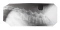 Film with X-ray image of side view of human spine Royalty Free Stock Photo