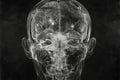 film x-ray skull of person