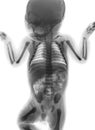 Film x-ray whole body of normal infant . front view Royalty Free Stock Photo