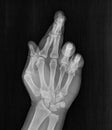Film xray x-ray or radiograph of a hand and fingers showing Fingers crossed, hand gesture. Lie, good luck, hope, optimism