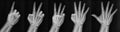 Film xray x-ray or radiograph of a hand and fingers showing the numbers one through five 1-5. One, two, three, four five in