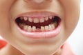 Finally first baby teeth out toothless boy smile Royalty Free Stock Photo