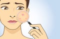 Finding acne with magnifier