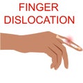 Finger Dislocation human medical organ vector illustratio.