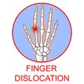 Finger Dislocation human medical organ vector illustratio.